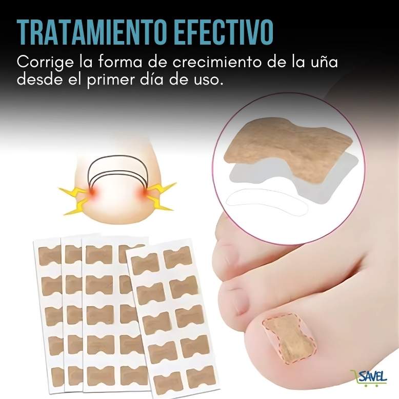 NailFix® Olvídate de sufrir de uñas encarnadas