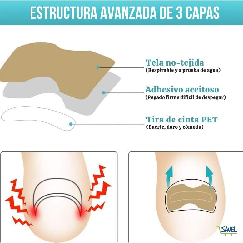 NailFix® Olvídate de sufrir de uñas encarnadas