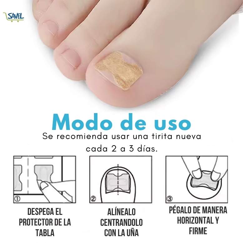 NailFix® Olvídate de sufrir de uñas encarnadas