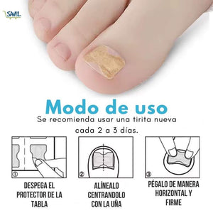 NailFix® Olvídate de sufrir de uñas encarnadas
