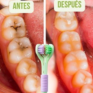 Multi Teeth®: Limpieza completa en segundos