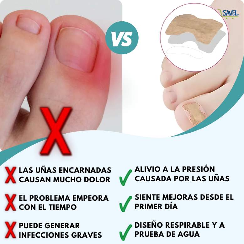NailFix® Olvídate de sufrir de uñas encarnadas