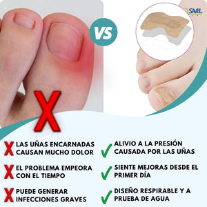 NailFix® Olvídate de sufrir de uñas encarnadas