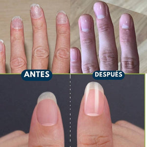 BeautyNail Pro®: Haz que tus uñas asombren a todos