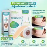 SkinPatch: Cinta de Silicona para Reducción de Cicatrices