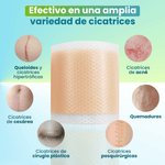 SkinPatch: Cinta de Silicona para Reducción de Cicatrices